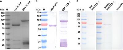 The Putative TCP-1 Chaperonin Is an Important Player Involved in Sialic Acid-Dependent Host Cell Invasion by Toxoplasma gondii
